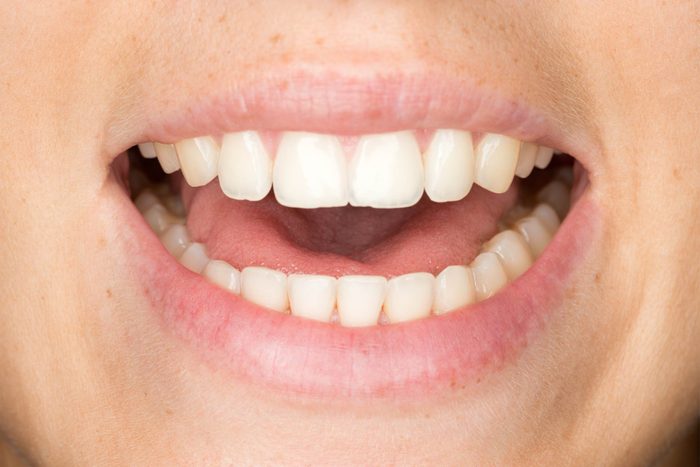 Person opening their mouth to speak.