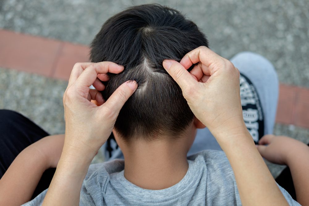 Mother is catching hair to find lice and treatment hair in children.