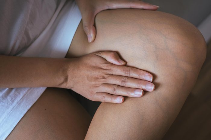 woman touching painful leg 
