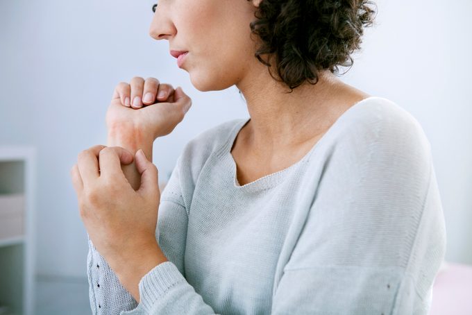 woman itching her wrist