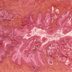 "Here's How I Knew I Had a Hormone Imbalance": A Patient's Firsthand Experience